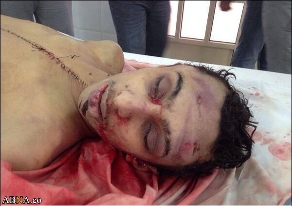 Bahraini forces kill 19-year old Shiite protester (GRAPHIC)
