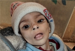 Syria: Palestinian Refugees Eat Animals to Survive
