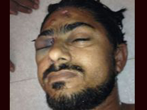 کراچی میں دہشتگردوں کی فائرنگ سے مولانا محمد اکبر حسین شہید ہوگئے