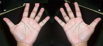 Amazing Marks on Your Hands (Image)