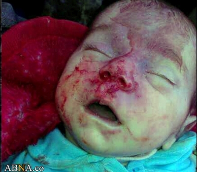 Image / Shia Baby Martyred in Mortar Attacks on Syria