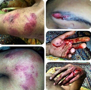Bahrain: Abducted, Beaten and Threatened