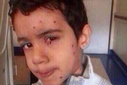 Bahraini children not excluded from official violence