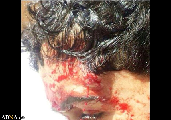 Die bahrainischen Demonstranten werden unterdrückt