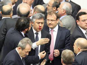 Принятие закона о судьях в Турции закончилось сломанным носом