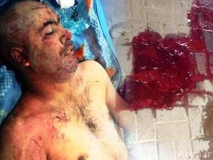 استشهاد واصابة 7 اشخاص برصاص الأمن السعودي في العوامية + صور