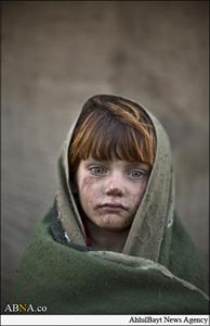 Pakistanın Hələbi Abad məntəqəsindəki Əfqanıstan müharibəsinin uşaq qurbanları + Foto