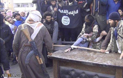 GRAPHIC IMAGES: Muslim extremists cut off man's hand and post pictures on Twitter