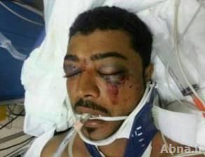 المصاب عبدالعزيز العبار تعرض لنزيف خارجي في الرأس ولازال في "غيبوبته" وحالته "خطرة"