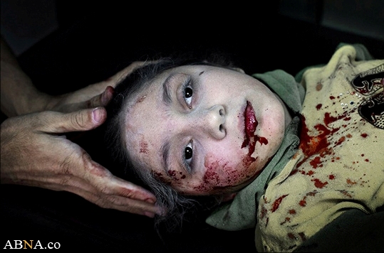 صورة فتاة سورية تفوز بجائزة "اليونسيف"