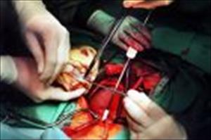 Iran bei Herztransplantationen weltweit an der Spitze