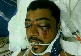 Bahrain: Victim Of Police Shooting Suffers Critical Brain Injury, Remains In Coma