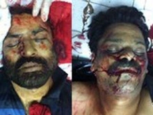 Two Shia Muslims martyred in Karachi - Pakistan