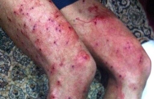 Bahrain: wide arrests and home raids during Formula 1 race