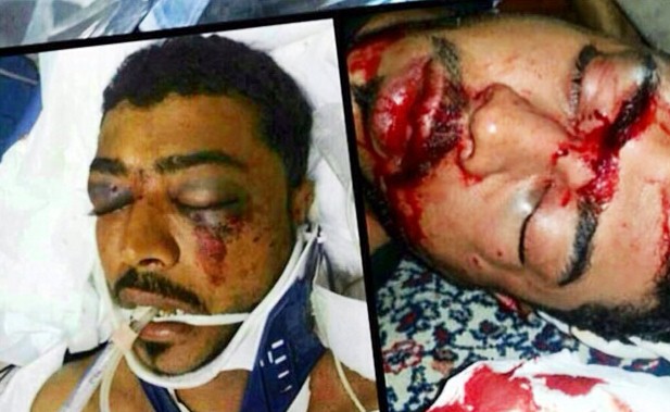 الشاب «عبد العزيز العبار» استشهد بعد إصابته بمقذوف ناري بشكل مباشر في منطقة الرأس