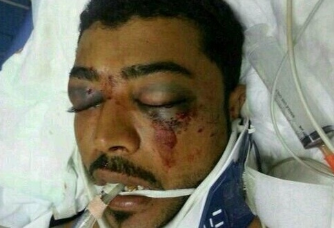Bahrain: Body of martyr remains in regime custody due to refusal to document reason of death