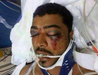 21 يوماً على احتجاز السلطات لجثمان الشهيد عبدالعزيز العبار