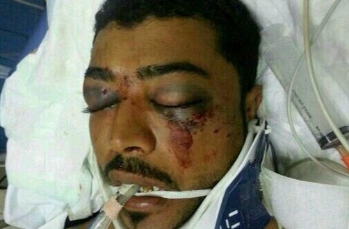 Detention of Abd Al Aziz Al Abbar Corpse is an acknowledgement of the Impunity Policy in Bahrain