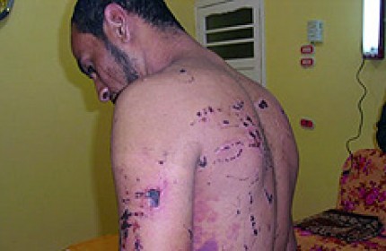 46 pays condamnent la poursuite de la violation des droits de l’Homme, à Bahreïn 