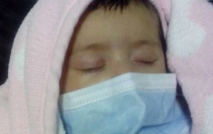 استهداف مستشفى خاص بالغازات و حادثة اختناق رضيعة في البحرین