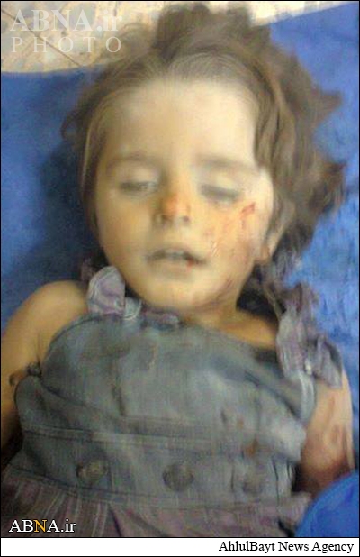 تصویر: جبهه‌النصره  کے راکٹ حملوں سے ایک شیعہ بچی شہید 