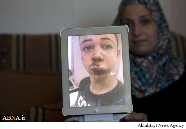 صہیونی فوجیوں کی بربریت کا ثبوت + تصویر