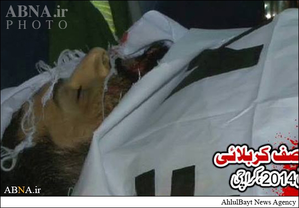 ملعون دھشتگردوں کے ہاتھوں شیعہ رہنما آصف کربلائی کی شہادت+ تصاویر