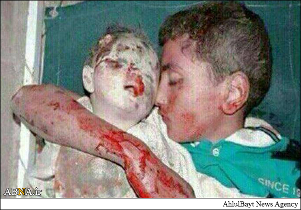 Israel emulates the Nazis in slaughtering children 