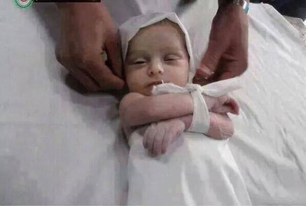 مصر نے فلسطینی زخمیوں کے لیے سرحد کھول دی