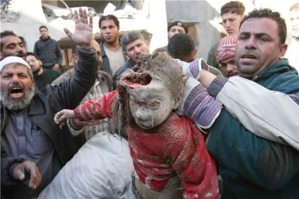 “El régimen de Israel ha Utilizado Fósforo Blanco contra la Población Civil de Gaza”