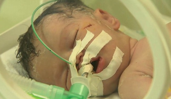 Baby einer getöteten Mutter geboren