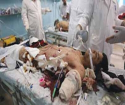 انسانی اعضاء کی اسمنگلنگ میں اسرائیل ملوث
