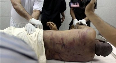 “HRW ha Instado Régimen de Baréin a Proporcionar la Rehabilitación a las Víctimas de Tortura”