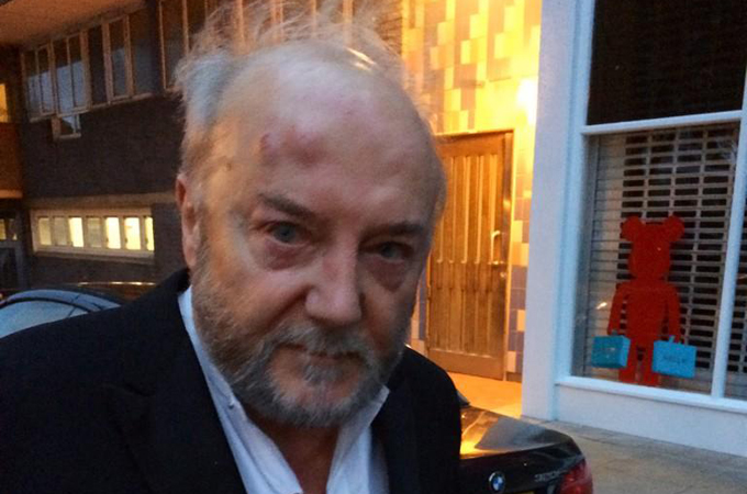 Anti-Israeli British MP injured by Zionist assailant