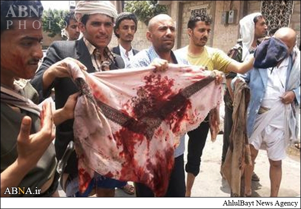 یمن کے انقلابیوں کے پامال شدہ حقوق انہیں واپس ملنا چاہیے