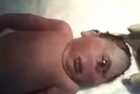 One-Eyed Baby is Used as an ISIS Recruiting Tool