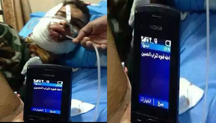  Wounded Soldier, "Willing to Sacrifice for the Sake of Imam Hussein