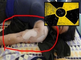 IŞİD, Kobani’de kimyasal silah kullandı / Foto