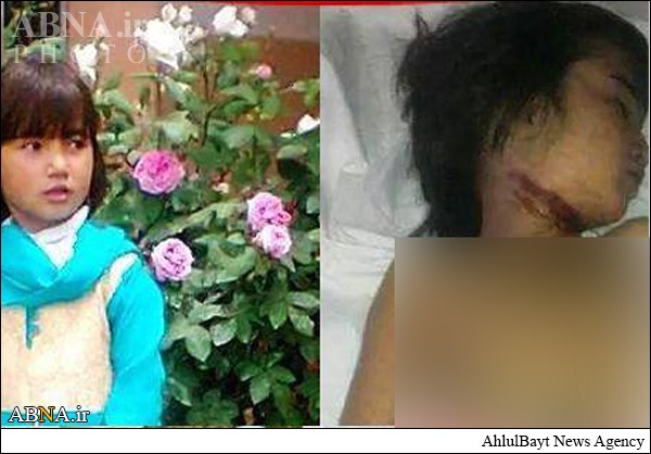 Pakistan: A 6-year-old Shia girl beheaded / Pics