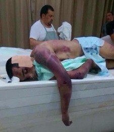 صور من "المغتسل" لسجين في معتقل "جو" تعرض إلى تعذيب وحشي