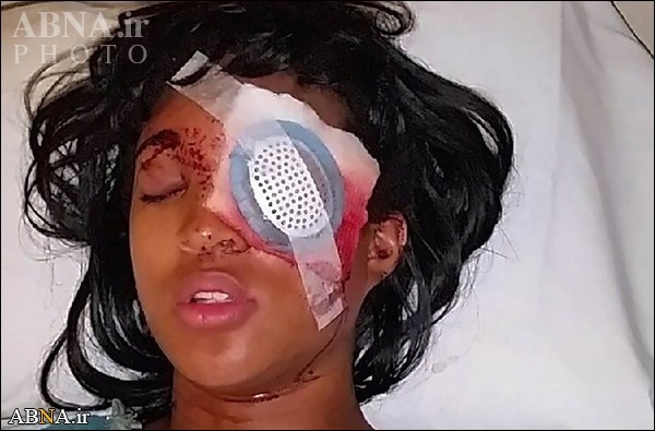 АБШ полиси бу дәфә гарадәрили һамилә гадына атәш ачараг ҝөзүн кор етди – Фото