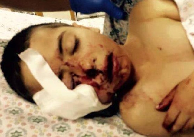 إصابة طفل فلسطيني برصاصة في الوجه من مسافة قريبة على يد جندي إسرئيلي