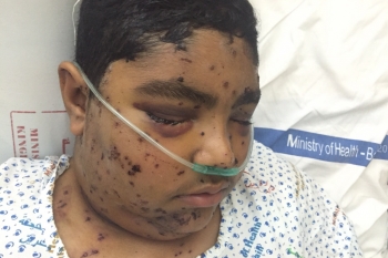 Bahrain: 14-year-old boy risks losing eye after being targeted in peaceful protest