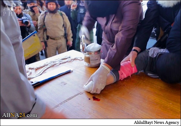 Photos: ISIL Cut Off the Hands of 3 Iraqis in Ninawa