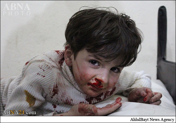 Photos: Syrian children victims of ISIS rocket attacks