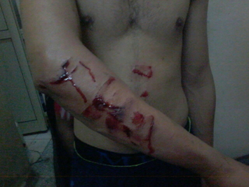 NGOs condemn the violent attack on Prisoners at Bahrain Central Prison Jaw