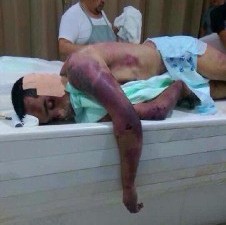 صور/ احتراق ذراع وتعذيب المعتقلين في أحداث «سجن جوّ» 