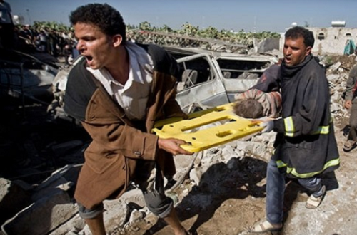 Kapat gözlerini; Yemen ölüyor!