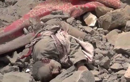 Suskun Ümmetin Yemen Zilleti
