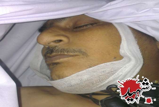 امام بارگاہ قبہ سکینہ کے ٹرسٹی اور ڈپٹی ڈائریکٹر کے ڈی اے اشرف عباس شہید، بیٹی زخمی